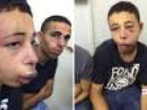 شهيد ومصاب في تجدد العدوان الصهيوني على غزة